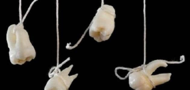 تأويلات سقوط الاسنان في المنام